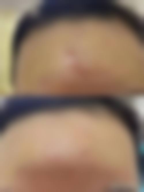 曹志明医生在哪家医院怎么预约？