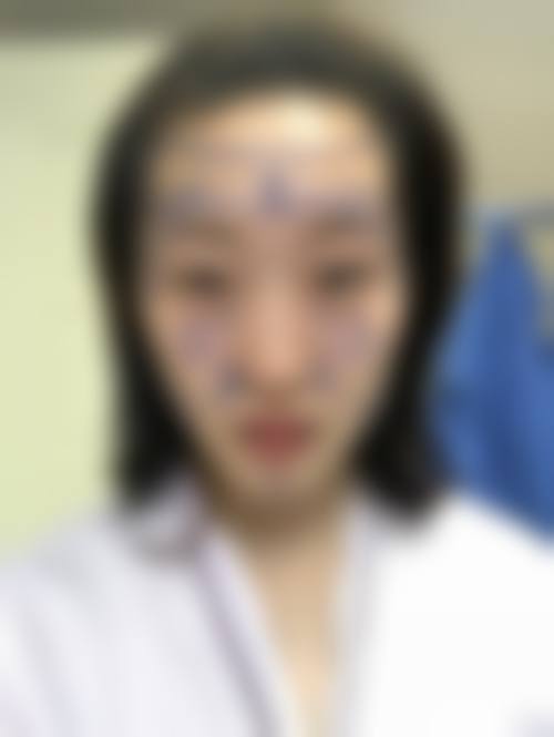 张家钧医生怎么样可靠吗？
