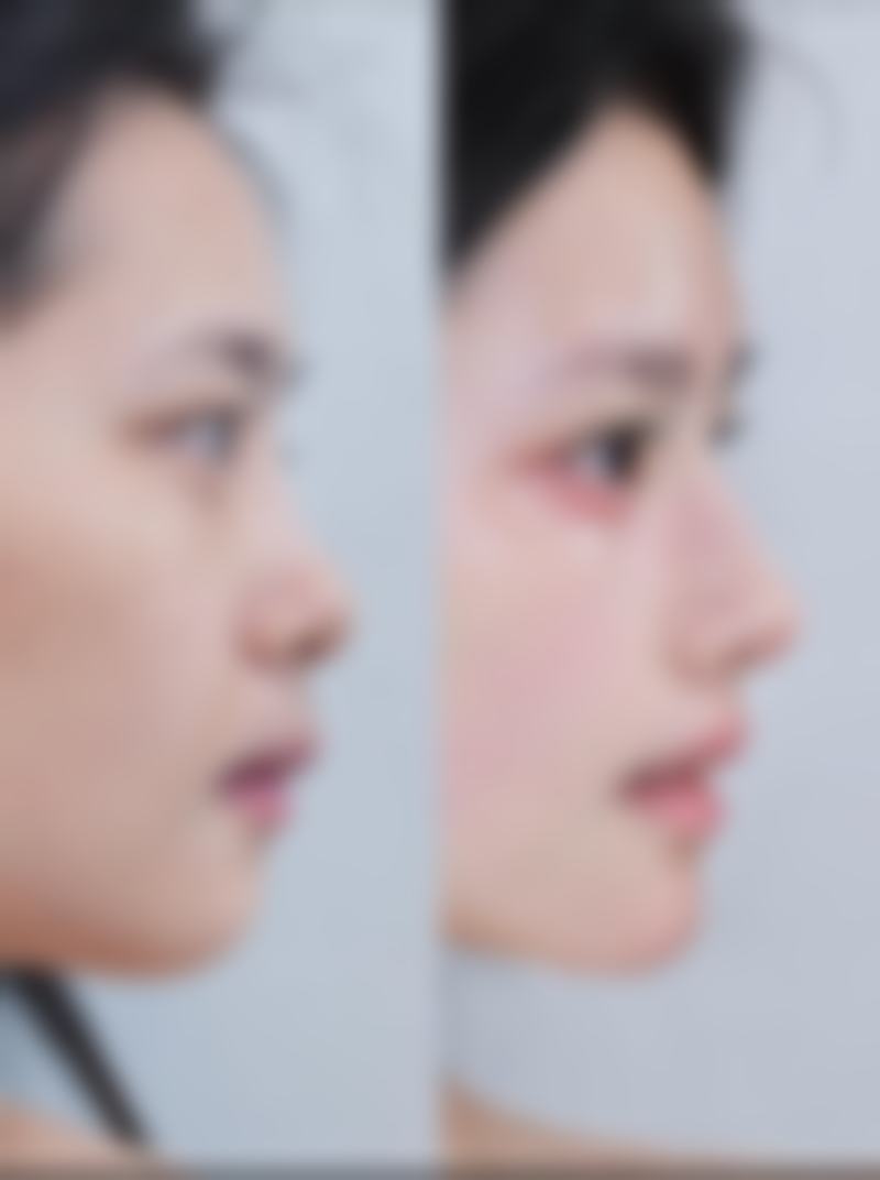 六、伊犁梵洛希整形医院价格表:(仅供参考)