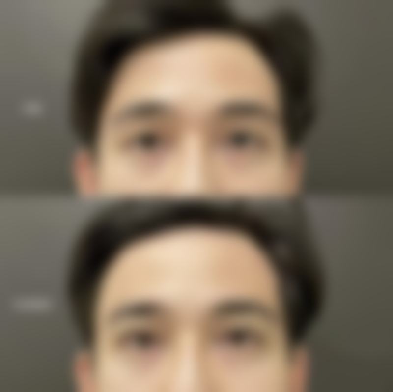 六、钏路美容外科诊所价格表：（仅供参考）