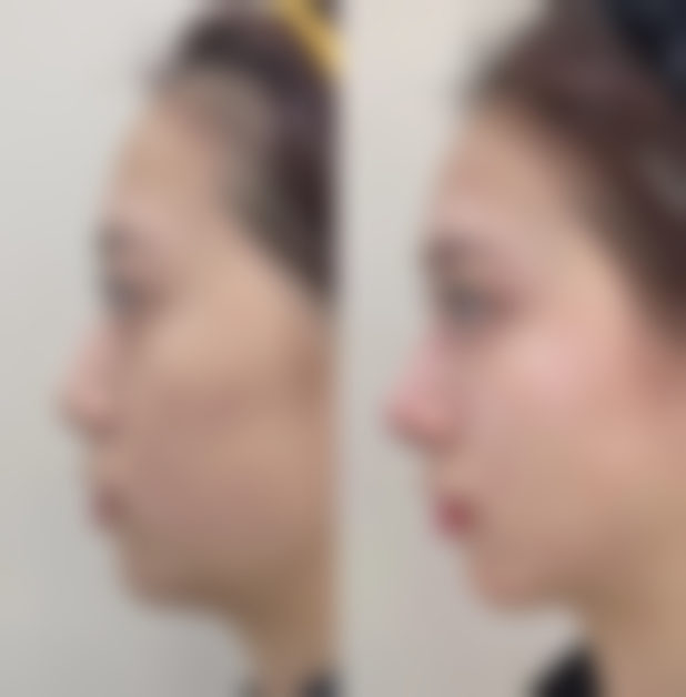 六、佛山市生命加整形医学美容门诊怎么预约: