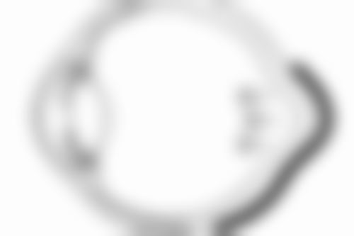 许昌正美韶华医疗整形郝文玉擅长的瘦脸项目技巧