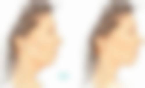 面部缝合疤痕如何去除？多种疗法结合+日常护理，淡化疤痕重塑光滑肌肤 