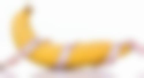 切开双眼皮维持时间总结:多数3 - 20年,护理修复助力持久之美