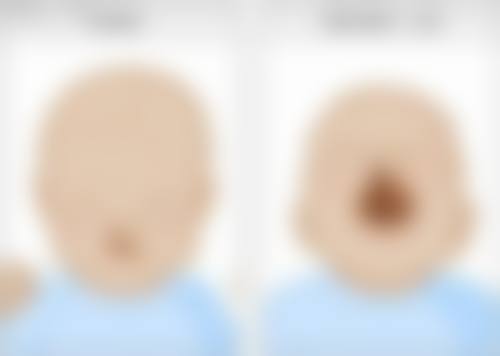 五、西安琅丽医疗美容实例