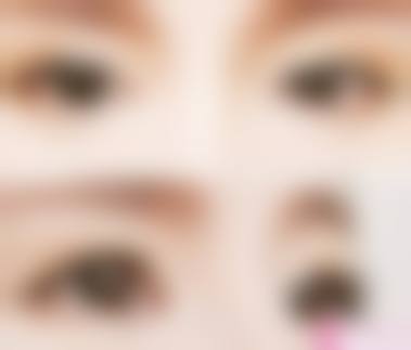 四、乌兰察布张兵整形美容门诊部实例