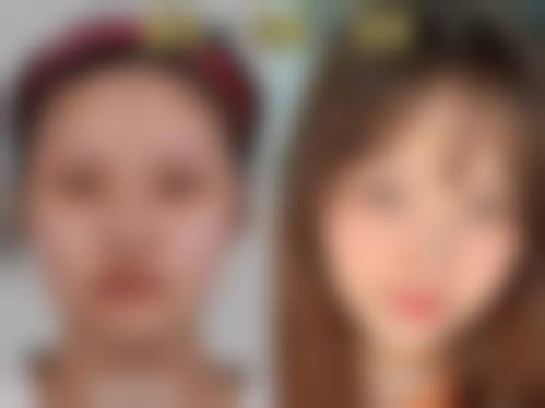 五、周口李全民医疗美容诊所实例