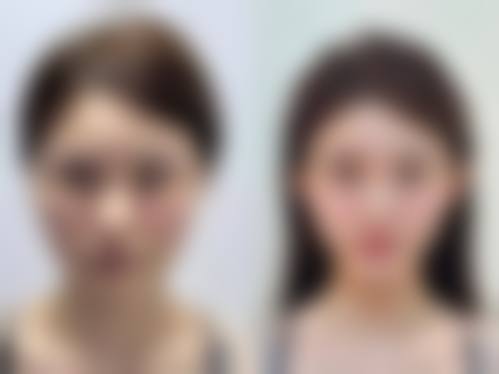 三、北京新氧医生汇整形美容医院医生介绍: