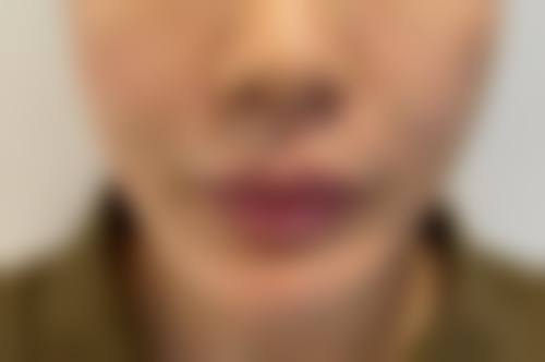 五、北京新氧医生汇整形美容医院实例