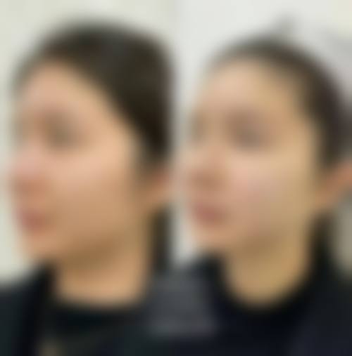 八、周口李全民医疗美容诊所真实的顾客评价如下：