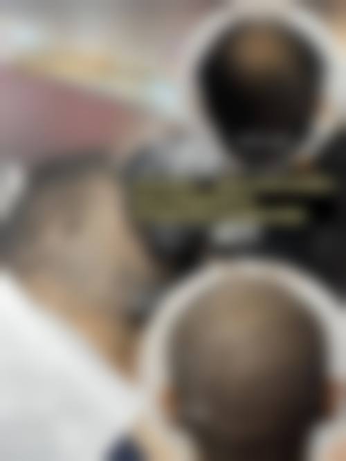 四、佛山新生植发医疗美容门诊部实例