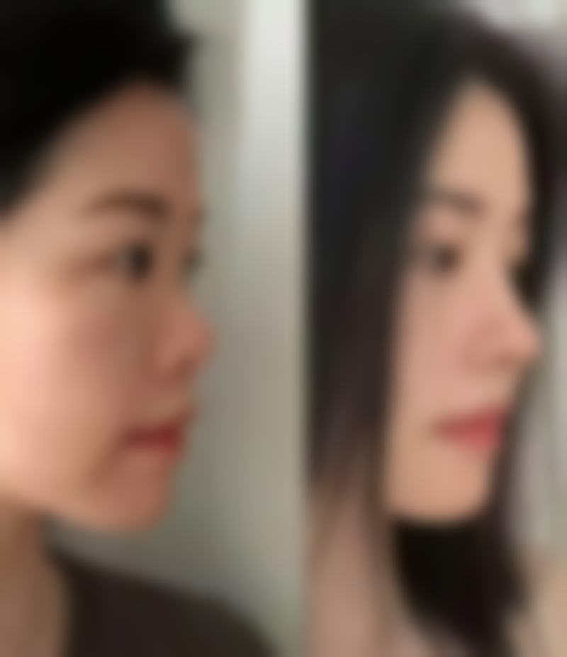 许昌正美韶华医疗整形郝文玉9年经验的优势体现