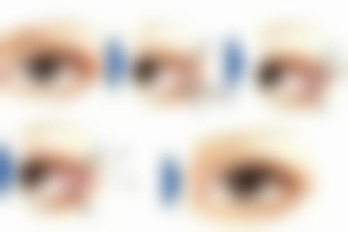 疤痕体质祛疤难题如何破解？遵循治疗前提是保护