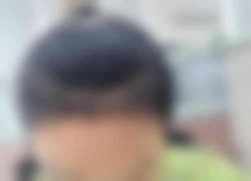 五、四川省红十字肿 瘤医院整形科实例