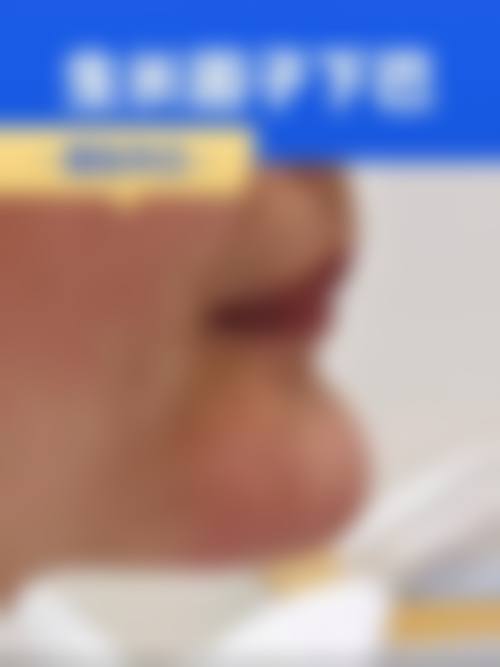 七、四川省红十字肿 瘤医院整形科价格表：（仅供参考）