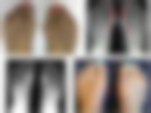 其他祛眼袋妙招之日常护理方式