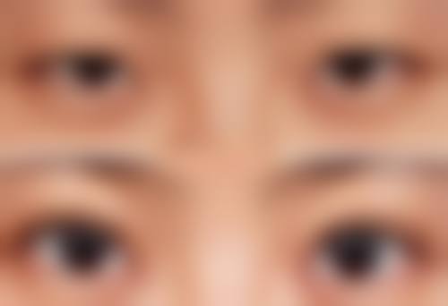 总结：鸡蛋滚眼及其他祛眼袋妙招