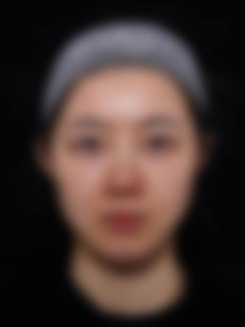 五、韩国CHA&YOU整形皮肤科实例