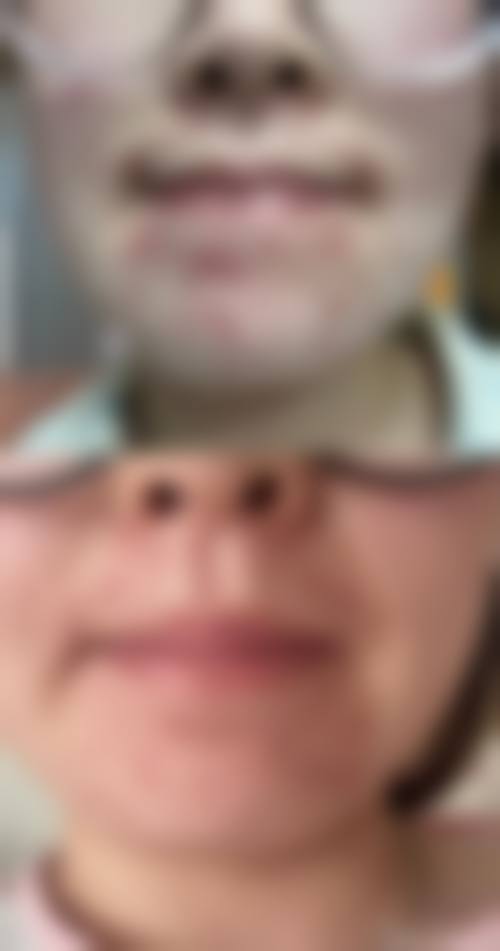 文前龙医生怎么样可靠吗？