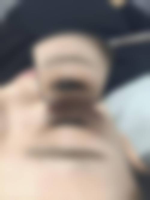 七、yuno整形外科价格表：（仅供参考）