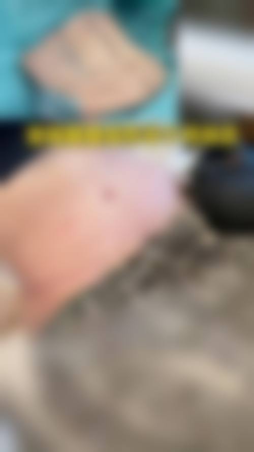 五、深圳民生妇科医院整形美容中 心实例