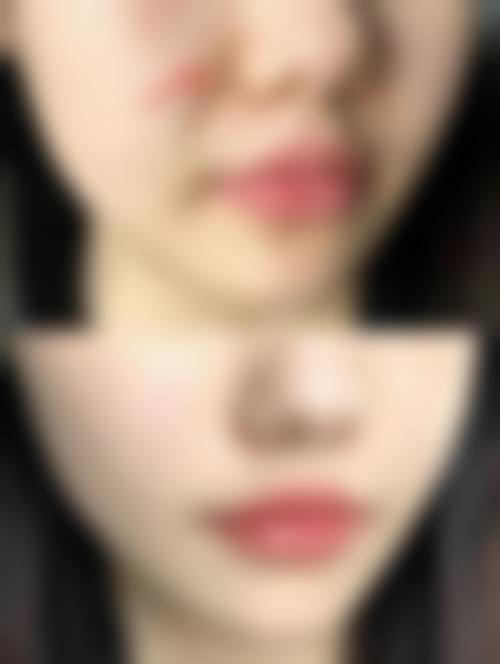 六、深圳民生妇科医院整形美容中 心怎么预约：