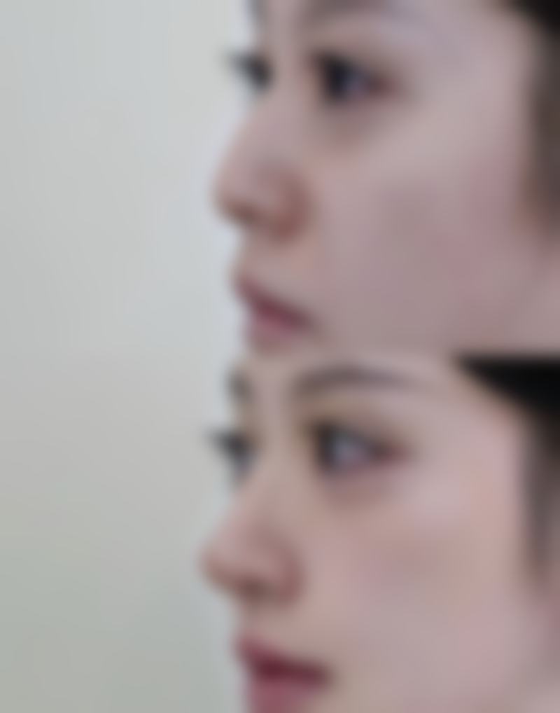 八、yuno整形外科真实的顾客评价如下：
