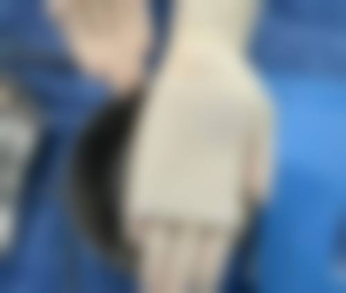 掌握加速修复通用建议，快速拥有美丽双眼皮