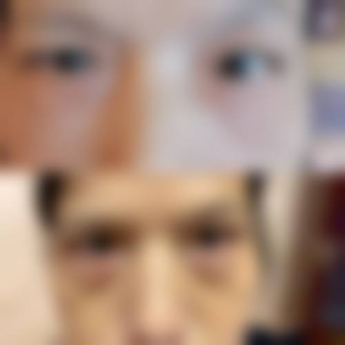 五、苏州屈新华整形医院实例