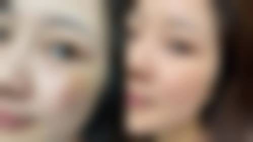 七、品川皮肤科诊所品川总院真实的顾客评价如下：