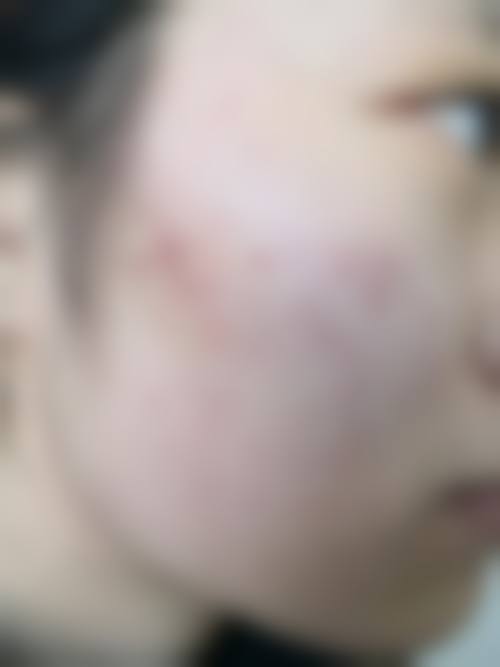 六、重庆张辉医疗美容诊所怎么预约：