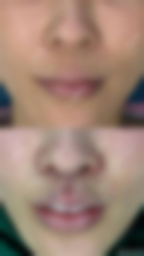 五、重庆张辉医疗美容诊所实例