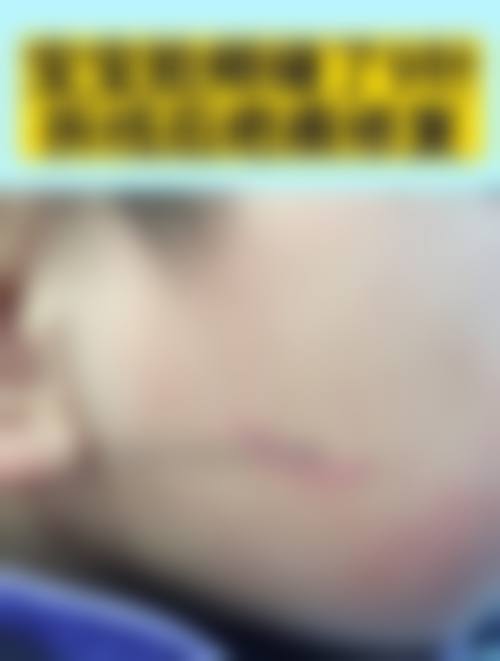 六、深圳和平医院整形美容科价格表：（仅供参考）