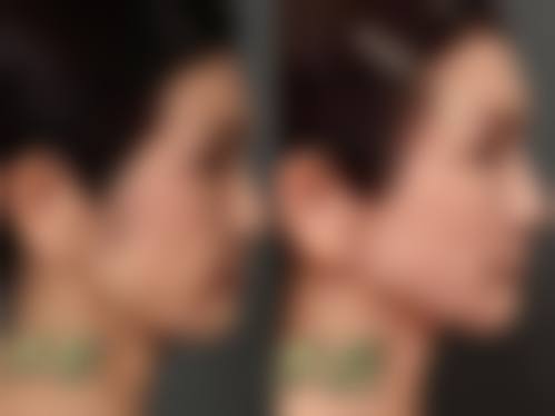 三、深圳和平医院整形美容科基本信息：