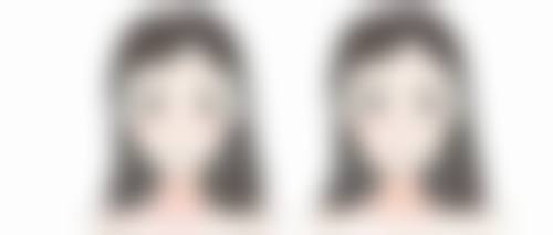 疤痕增生能否做光子嫩肤？了解适用场景，光子嫩肤助软化凸起、淡化疤痕色素 