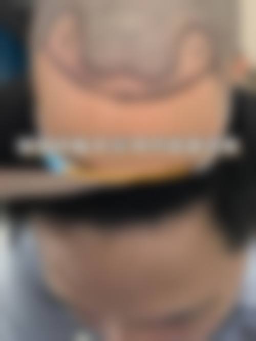 二、临沂艺生植发医疗美容门诊部正规吗？来看看医院资质：