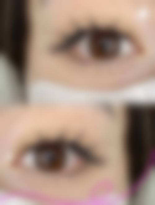 五、临沂艺生植发医疗美容门诊部实例