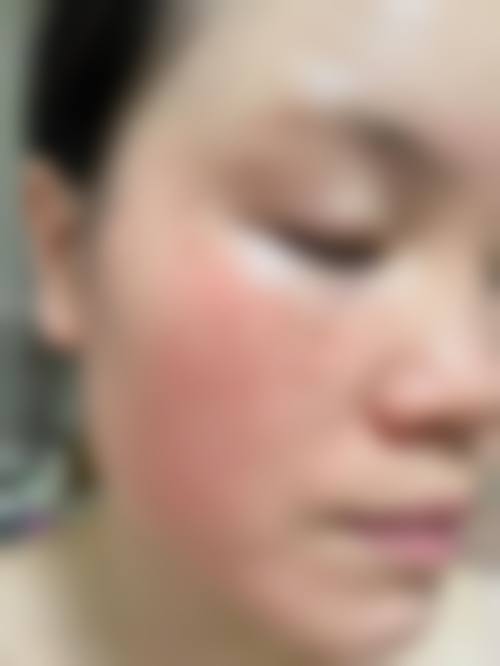 六、南京光尔美整形医院怎么预约：