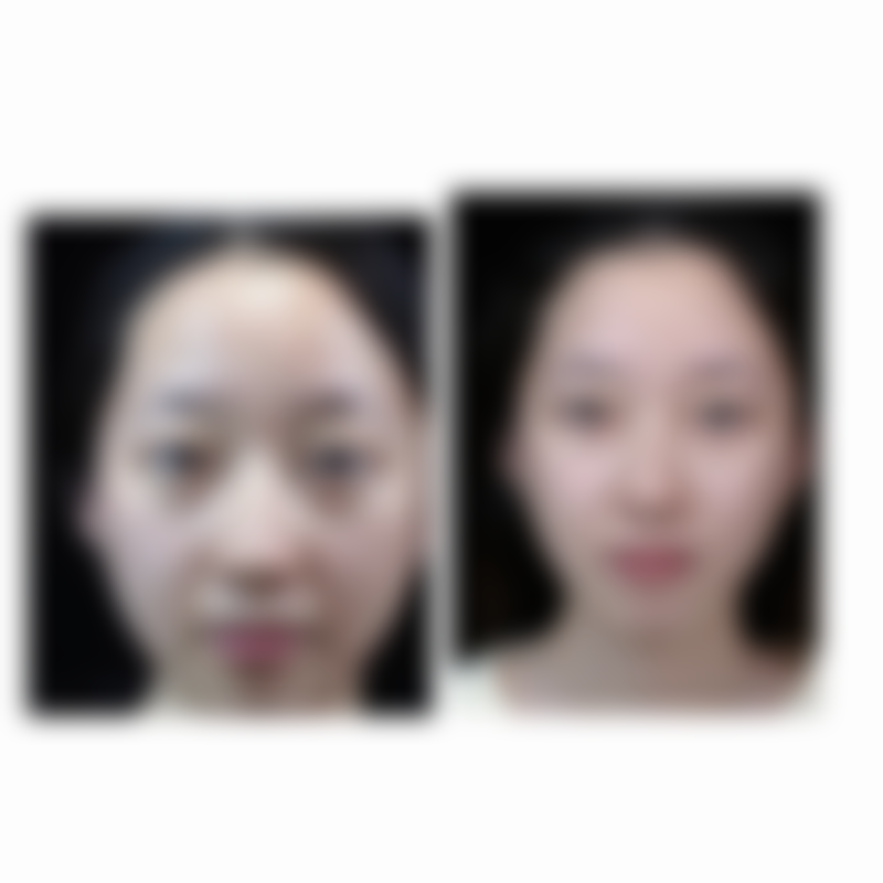 七、韩国Schedule皮肤科真实的顾客评价如下