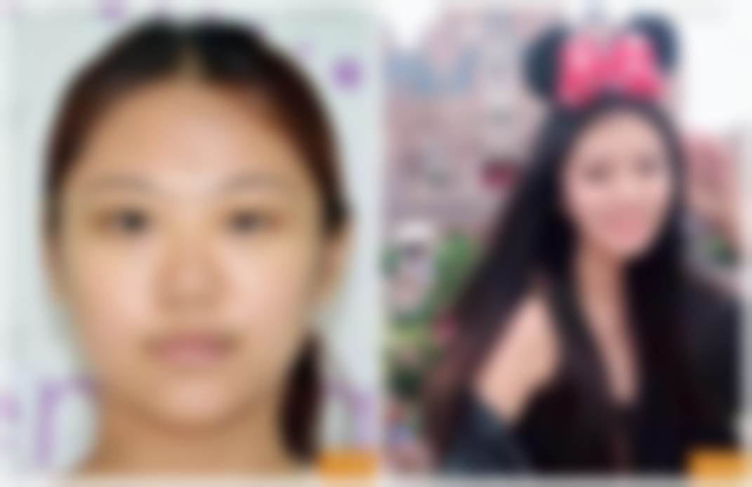 李梦莹医生实例