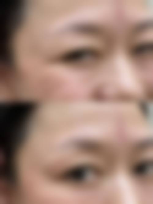 尹婷微医生实例