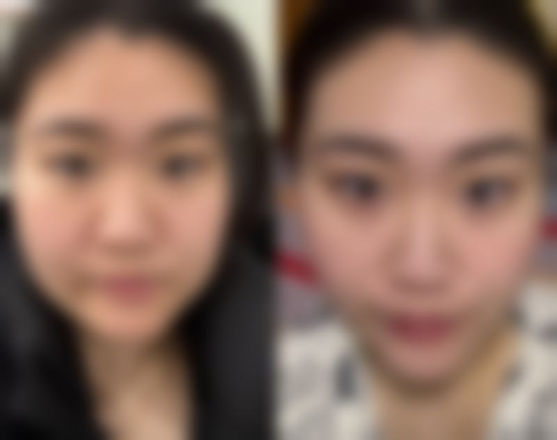 七、合肥市第二人民医院整形美容科价格表：（仅供参考）