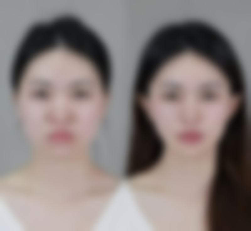 五、福州珞伊医疗美容诊所怎么预约：