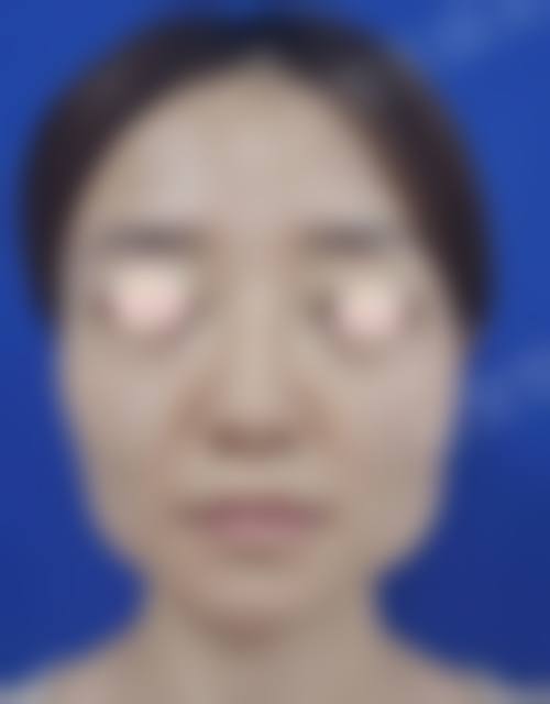 五、中山大学附属第三医院整形美容科实例