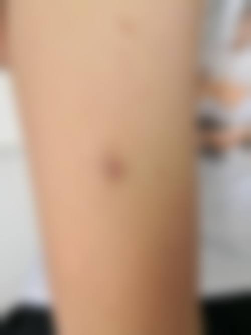 八、武汉星嘉颜医疗美容诊所真实的顾客评价如下：