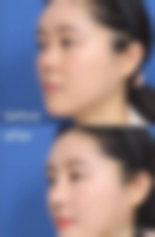 八、韩国VG整形外科真实的顾客评价如下：