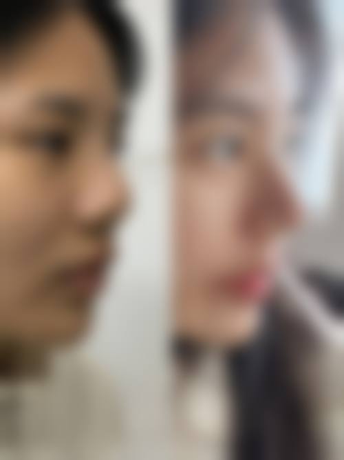 六、韩国VG整形外科怎么预约：