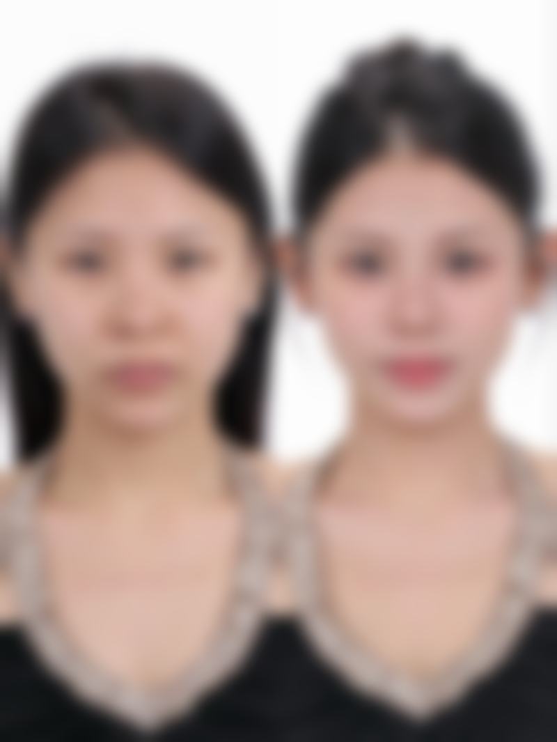 五、首尔丽温REON整形外科医院实例