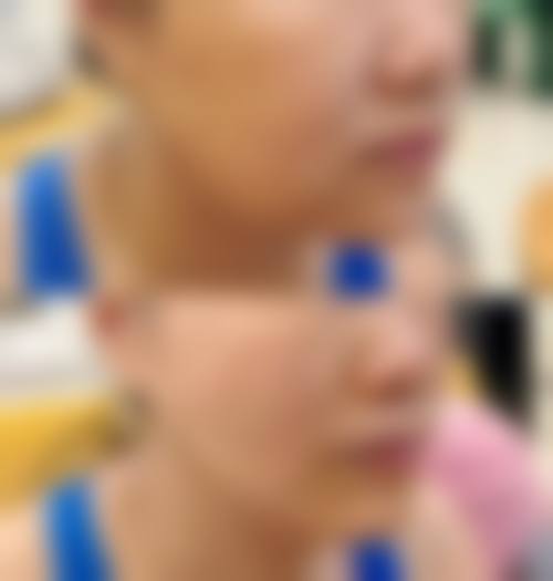 六、深圳春天海岸医疗美容门诊部怎么预约：