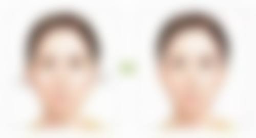 火龙果去眼袋是真的吗?总结火龙果改善眼袋的神奇作用